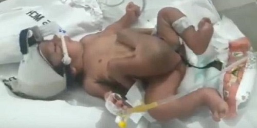 Bayi yang dilahirkan Lalitamma saat dalam perawatan.(independent.co.uk)